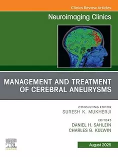 Management and Treatment of Cerebral Aneurysms