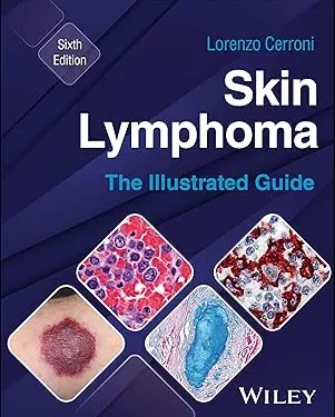 Skin Lymphoma: The Illustrated Guide