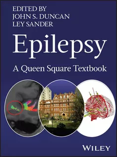 Epilepsy: A Queen Square Textbook