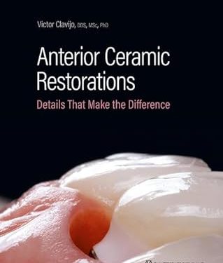 Anterior Ceramic Restorations: Details That Make the Difference