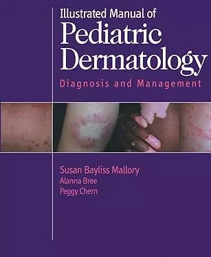 Illustrated Manual of Pediatric Dermatology: Diagnosis and Management