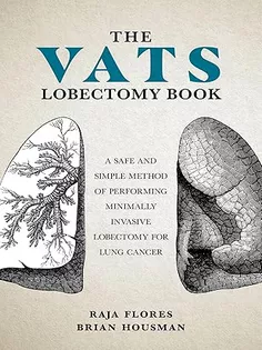 The VATS Lobectomy Book: A Safe and Simple Method of Performing Minimally Invasive Lobectomy for Lung Cancer