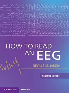 How to Read an EEG