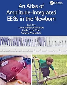 An Atlas of Amplitude-Integrated EEGs in the Newborn