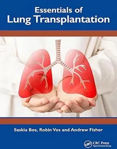 Essentials of Lung Transplantation