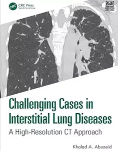 Challenging Cases in Interstitial Lung Diseases
