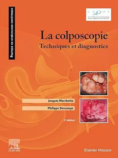 La colposcopie: Techniques et diagnostics