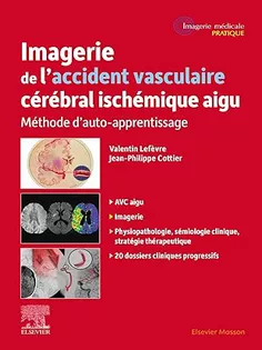 Imagerie de l'accident vasculaire cérébral ischémique aigu: Méthode d'auto-apprentissage