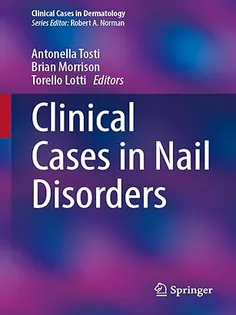 Clinical Cases in Nail Disorders (Clinical Cases in Dermatology)