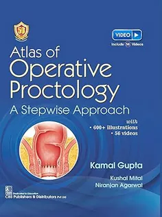 CBSPD Cbs Publishers And Distributors Pvt. Ltd. Atlas Of Operative Proctology A Stepwise Approach - 2024 Hardcover – 28 September 2023