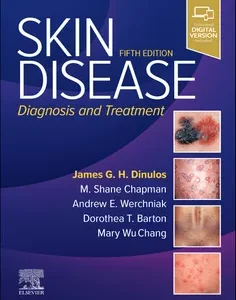 Skin Disease: Diagnosis and Treatment