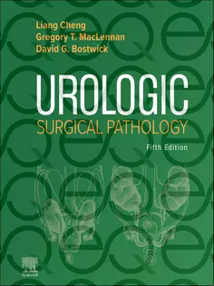 Urologic Surgical Pathology