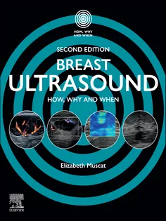 Breast Ultrasound