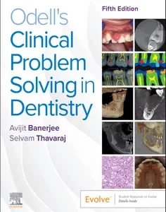 Odell's Clinical Problem Solving in Dentistry