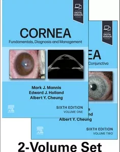 Cornea, 2-Volume Set