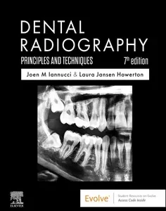 Dental Radiography: Principles and Techniques