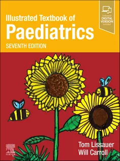 Illustrated Textbook of Paediatrics