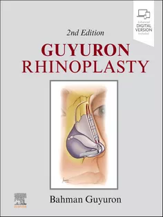 Guyuron Rhinoplasty