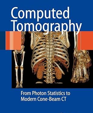 Computed Tomography: From Photon Statistics to Modern Cone-Beam CT