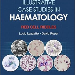 Illustrative Case Studies in Haematology: Red Cell Riddles