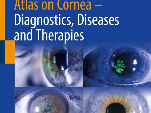 9783031654213 Atlas on Cornea: Diagnostics, Diseases and Therapies