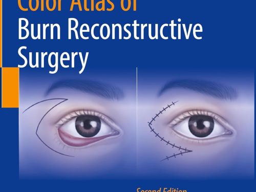 Color Atlas Of Burn Reconstructive Surgery