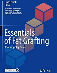 Essentials of Fat Grafting: A Step-by-Step Guide