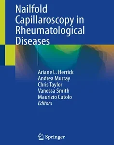 Nailfold Capillaroscopy in Rheumatological Diseases