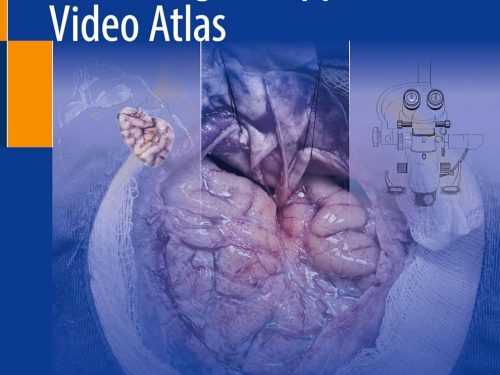 Neurosurgical Approaches Video Atlas