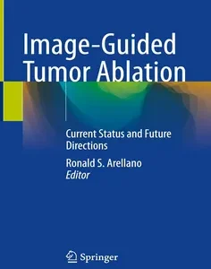 Image-Guided Tumor Ablation: Current Status and Future Directions