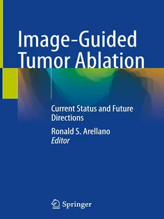 Image-Guided Tumor Ablation: Current Status and Future Directions