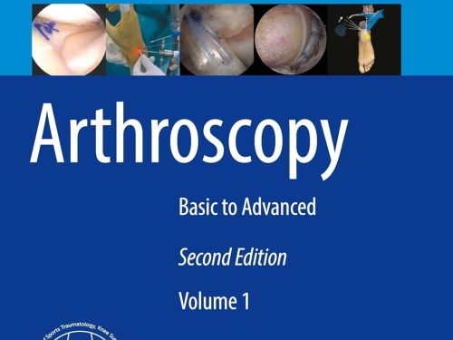 Arthroscopy: Basic to Advanced