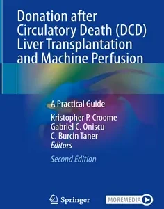 Donation after Circulatory Death (DCD) Liver Transplantation and Machine Perfusion: A Practical Guide