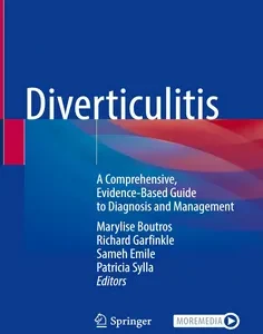 Diverticulitis: A Comprehensive, Evidence-Based Guide to Diagnosis and Management
