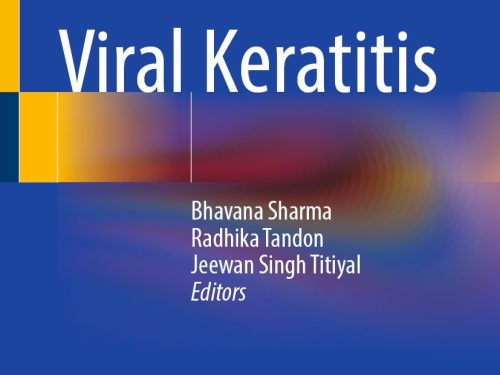 9789819531479 Viral Keratitis