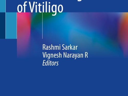 9789819538577 A Concise Guide to The Management of Vitiligo