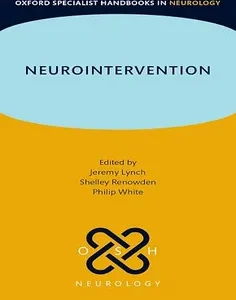 Neurointervention (Oxford Specialist Handbooks in Neurology)