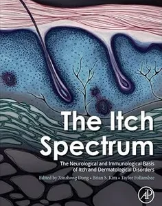 The Itch Spectrum