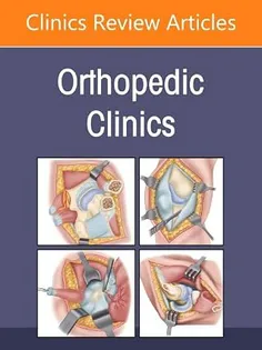 Minimally Invasive Surgery, An Issue of Orthopedic Clinics