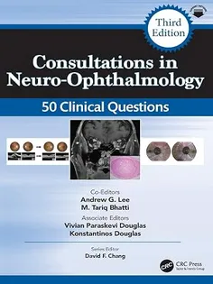 Consultations in Neuro-Ophthalmology (Curbside Consultation in Ophthalmology)