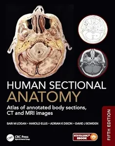 Human Sectional Anatomy: Atlas of annotated body sections, CT and MRI images