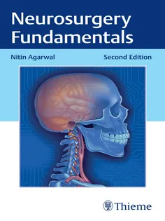 Neurosurgery Fundamentals