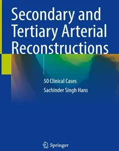 Secondary and Tertiary Arterial Reconstructions: 50 Clinical Cases