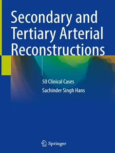 Secondary and Tertiary Arterial Reconstructions: 50 Clinical Cases