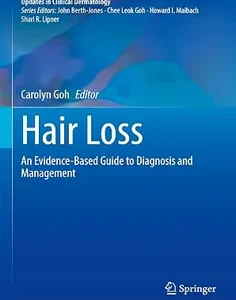 Hair Loss: An Evidence-Based Guide to Diagnosis and Management (Updates in Clinical Dermatology)