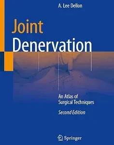 Joint Denervation: An Atlas of Surgical Techniques