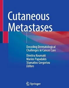 Cutaneous Metastases: Decoding Dermatological Challenges in Cancer Care