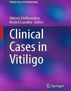 Clinical Cases in Vitiligo (Clinical Cases in Dermatology)