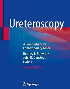 Ureteroscopy: A Comprehensive Contemporary Guide