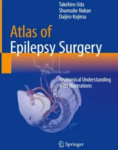 Atlas of Epilepsy Surgery: Anatomical Understanding with Illustrations